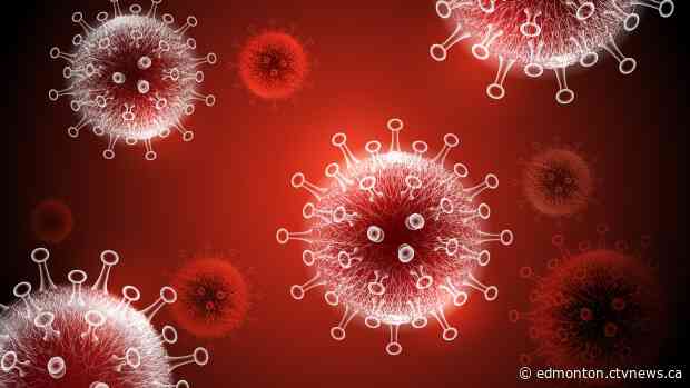 Alberta Health reports 243 new COVID-19 cases as hospitalizations reach 100