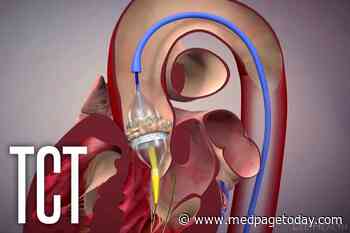 Mixed Results for Acurate Neo in Head-to-Head TAVR Trials