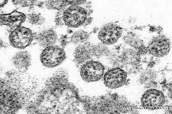 Possible COVID exposure in Regina, Saskatoon, Warman & Lloydminster - CKOM News Talk Sports