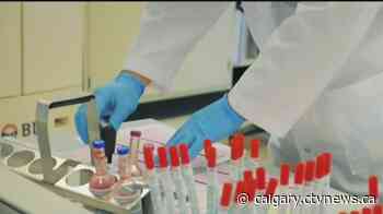 Lethbridge daycare with 18 confirmed COVID-19 cases temporarily closed by AHS - CTV Toronto