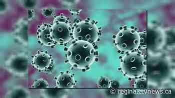 COVID-19 in Sask: 66 new cases, 18 in hospital