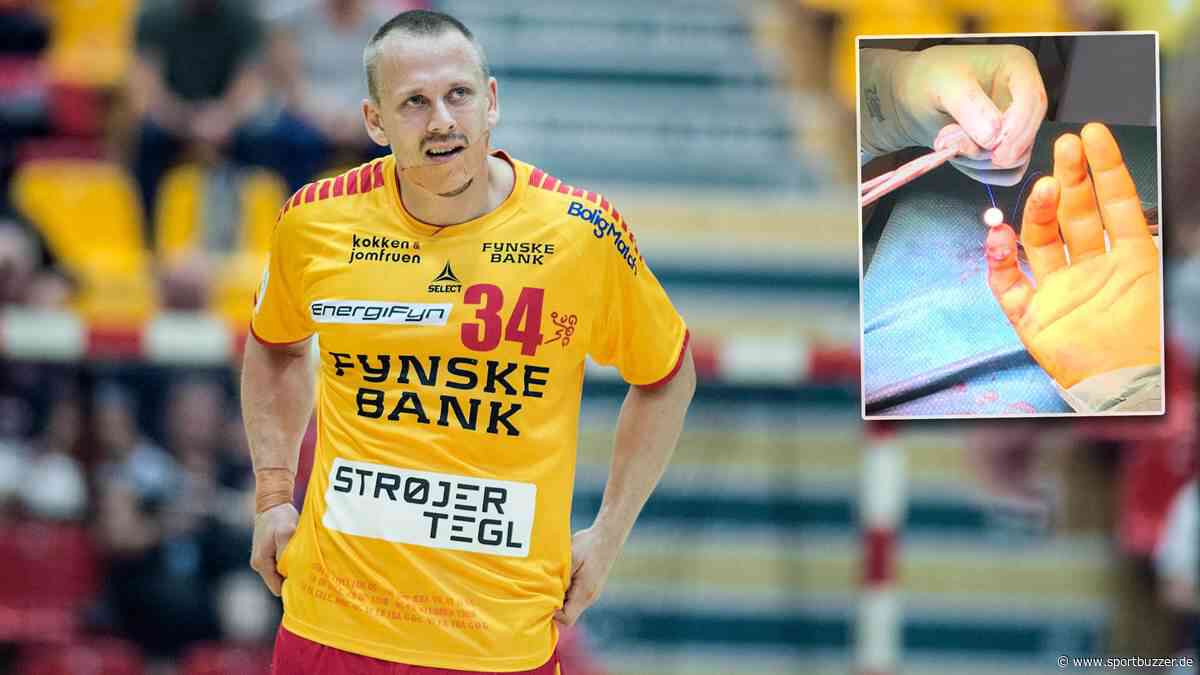 Amputation drohte: Ex-Recke Morten Olsen hat bei Horrorunfall "echt Glück gehabt" - Sportbuzzer