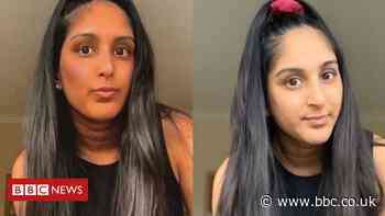 Instagram filters: 'Our skin is for life, not for likes'