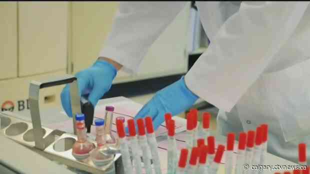 49 cases of COVID linked to Calgary wedding, 'aggressive' contact tracing underway