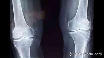 Medical Moment: Relieving knee pain - WNDU