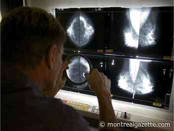 Women encouraged to still get mammograms during COVID-19 pandemic