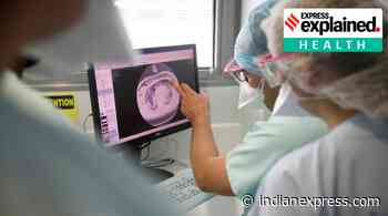Scientists grow ‘mini-lungs’ in lab, infect them with coronavirus and watch battle in real time - The Indian Express