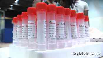 The Government of Saskatchewan announced 78 new cases of COVID-19 on Saturday