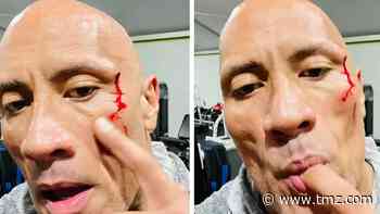 The Rock Tastes His Own Blood After Gym Injury, Gets Stitches to Close Gash