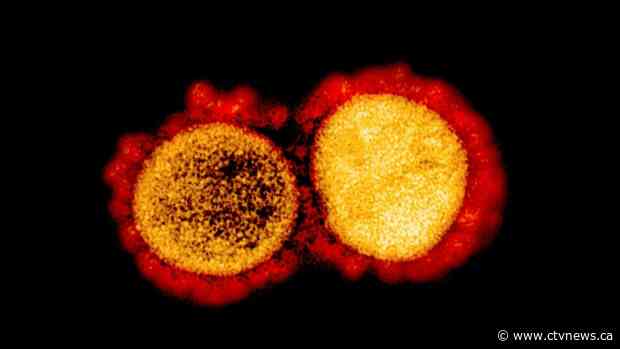 Government invests $1.9 million in COVID-19 immunity study of high-risk populations