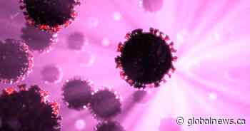 Saskatchewan reports 67 new coronavirus infections, active cases rise to 666