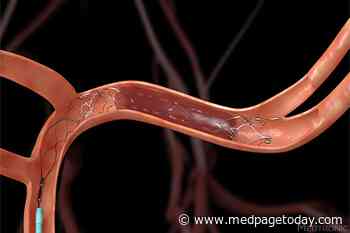 Endovascular Stroke Tx: Watch Out for Contrast-Induced Brain Swelling