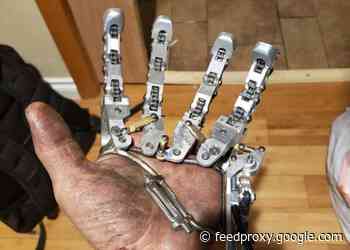 Amazing DIY mechanical prosthetic hand