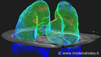 Radioterapia, a Modena nuovo sistema di calcolo per terapie sempre più sicure e precise - ModenaToday