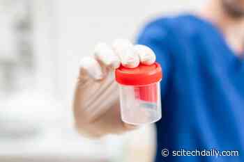 Norwegian Researchers Are Collecting Sperm From COVID-19 Patients – Here’s Why