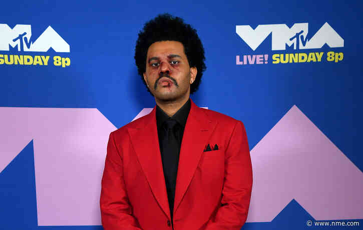 The Weeknd dressed up as The Nutty Professor for Halloween and it was brilliant