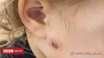 Halloween: Two-year-old girl struck by firework in Newry