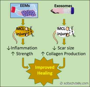 Possible New Treatment to Speed Healing of Ligament Injuries