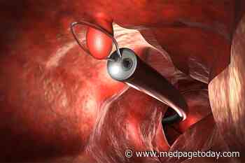New Guidance for Endoscopists on Malignant Polyps
