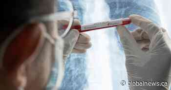 116 new cases of COVID-19 in Saskatchewan, 2 new deaths reported