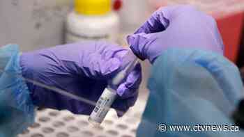 New Statistics Canada study to determine how many Canadians have been infected with COVID-19