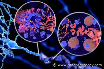 Study: Blood Biomarker Detects Early Alzheimer’s