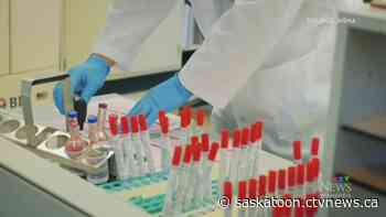 COVID-19 exposure warnings in Saskatoon, Lloydminster, Meadow Lake, North Battleford