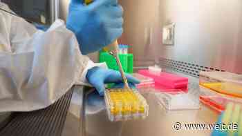 Die große Testhoffnung wurde gerade einmal an 426 Personen geprüft