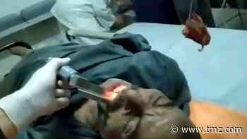 Egyptian Man Gets Live Fish Extracted from His Throat