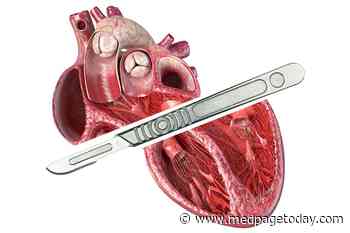 Patient's Ventricles Removed as Bridge to Heart Transplant