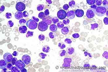 TKI Discontinuation Safe in CML, Improved PROs