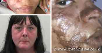 Mum suffered 'napalm-like' burns to face in Ladies Day piping hot pie attack