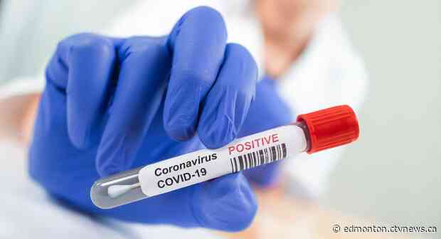 Alberta records over 1,000 new daily COVID-19 cases for first time, surpasses 400 deaths