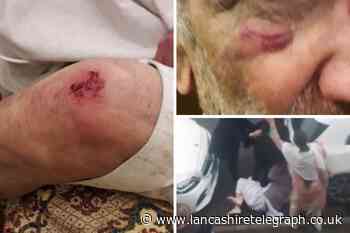 ‘They are cowards’ Pensioner, 78 beaten and kicked whilst on ground