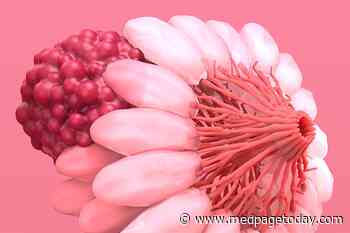 New Clinical Strategy for HR-Positive Breast Cancer?