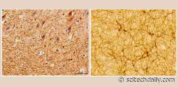 Neuroscience Meets Astrophysics: Does the Human Brain Resemble the Universe?