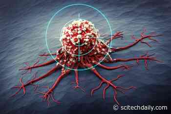 Antidepressant Sertraline (Zoloft) Helps Inhibit Growth of Cancer Cells