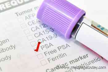 Clinical Challenges: Current Thinking on Active Surveillance