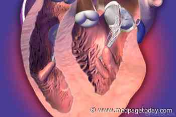 New HCM Guidelines Highlight Shared Decision-Making, Benefits of Exercise