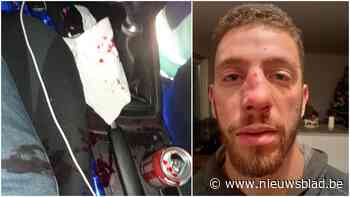 Detlev (28) stopt langs E403 en krijgt slaag: “We dachten eerst dat het agenten waren”