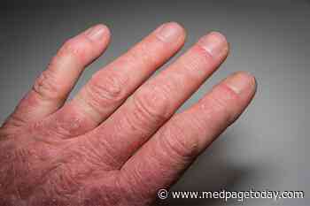 Clinical Challenges: Diagnosing Psoriatic Arthritis