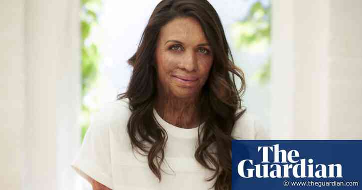 'I never take it off': Turia Pitt on her three most useful objects