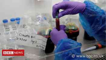 Lancashire Covid-test scientists 'work to rule' over pay dispute