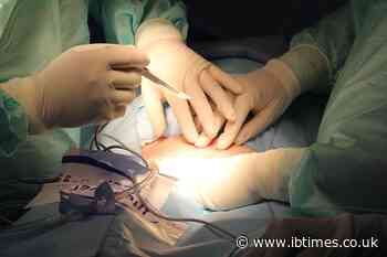 Popular weight loss surgery may lead to weakened bones in teens