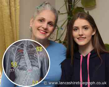 Teen undergoes life-changing surgery in Turkey