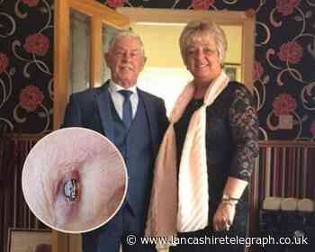 Royal Blackburn Hospital: Darwen couple shocked as man sent home with bulging pacemaker