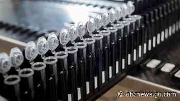 First blood test to help diagnose Alzheimer's goes on sale