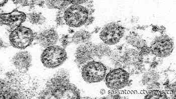 COVID-19 outbreak declared at North Battleford hospital