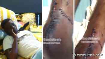 Boosie Badazz Reveals Gruesome Gunshot Injuries to Leg