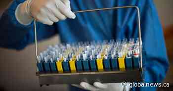 Alberta sets another daily COVID-19 record with 1,854 new cases